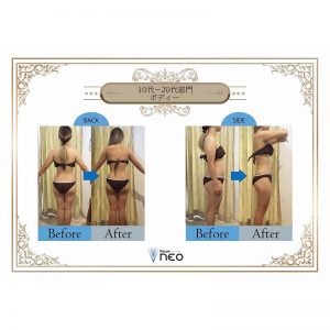 10代～20代部門 ボディー